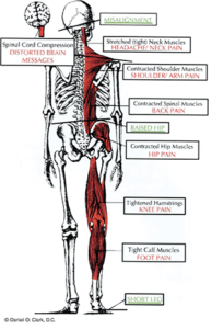 Body imbalance